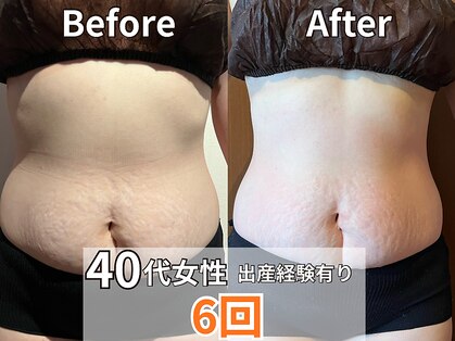マロカ(Marroka)の写真