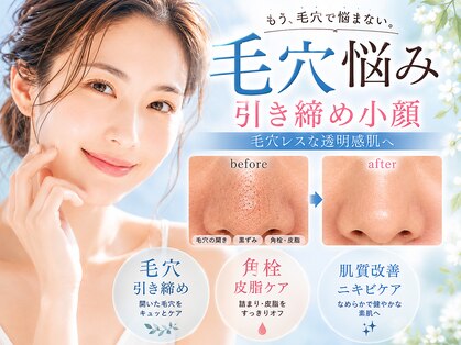 リノバイエース(INO by A)の写真