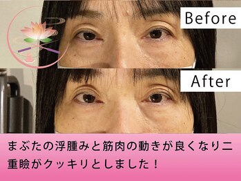 健美庵/本格美容鍼