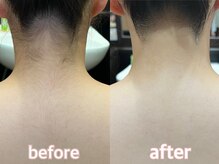 バーバーショップ 難波店(BARBER SHOP)/before/after