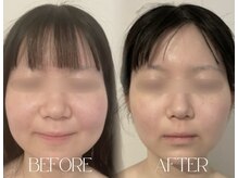 エッセンスビー 六本木(Essence Be)の雰囲気（骨切り後の術後ケアも経験と知識豊富なスタッフにお任せください）