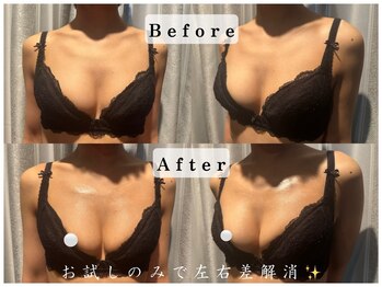 エステティックサロン パヒューム(Esthetic Salon Perfume)/左右差がなくなりサイズもUP!