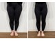 レナセール FUK 福岡店(RENACER FUK)の写真/【太ももを細くする】結果重視のパーソナル指導×マシンピラティス◎自分史上最高のラインへ導く★
