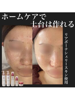 リベルテ 岡山(liberte)/リアボーテ正規取扱店
