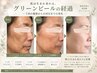 ［ドイツ皮膚専門士発祥グリーンピール5days】★アフターケア付￥55000→