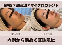 サロンドラヴィン(salon de Lovin)の雰囲気（1秒間に200万回振動する超音波でお肌汚れを除去！艶肌に整えます）