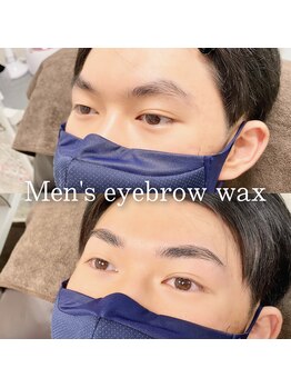 ソラ(sora)/ビフォーアフター