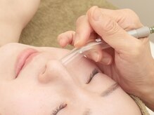 フリッシェ グラン(Frishe Gran)/毛穴の汚れは吸引管でしっかり