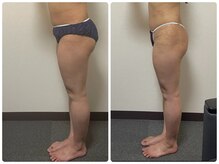 コクーン(COCOON)/下半身集中コース