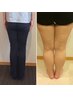 【太ももの張りや脚の歪みが気になる方】O脚整体◆美脚に♪