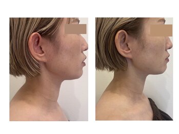 スリーク(threek)/