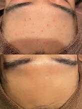 ジュエリーボディー(Jewelry body)/顔肌荒れで悩んでませんか？