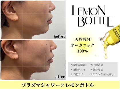 キビック(KIBIK)の写真