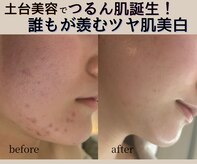 ユーアンドハニー(U&Honey.)