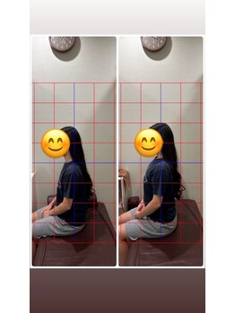 はぴねす鍼灸整骨院 玉造院/