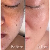 アールヨンマルハチ フェイスアンドアイ(R408.face&eye)