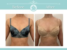 美人バスト 浦和店/【バストアップ★育乳】症例