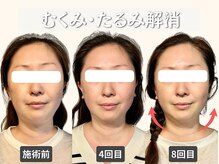 フレキシボディ(FlexiBody)の雰囲気（小顔矯正整体で中顔面のもたつき解消！すっきりした小顔へ！）