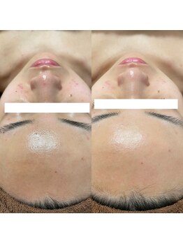 ナチュレ(Nature)/２週間に一回の艶肌習慣！