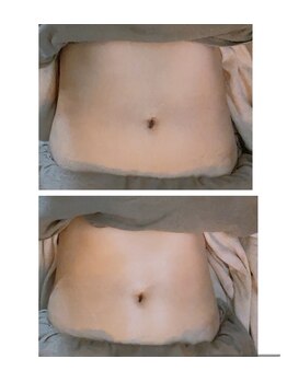 ヴァローレ(valore)/お腹ケアで縦べそに！