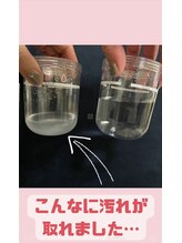 リラクゼーションサロン レボン(Rebon)/今話題の毛穴洗浄♪