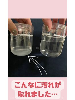 リラクゼーションサロン レボン(Rebon)/今話題の毛穴洗浄♪