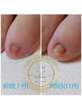 ウル('ulu)/☆自爪育成☆