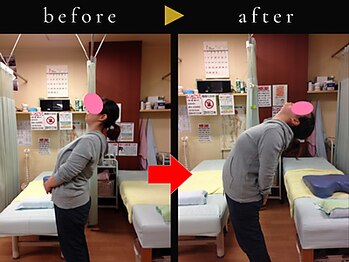 杉本接骨鍼灸院/若々しい背骨を取り戻す整体
