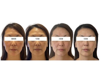 ソナ 大和西大寺院(SONA)/40代からのエイジングケアにも