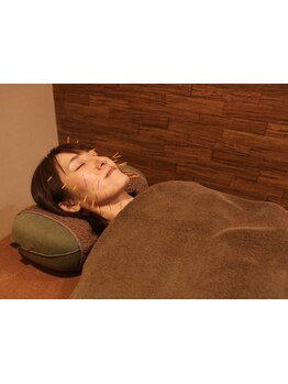 鍼灸施術を受けたい