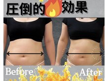 ラフィールの雰囲気（初回で即実感 !! サイズダウン・ビフォーアフターに自信あり。）