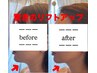【リフトアップ特化】広島市中区初導入＊SNSで話題の光フェイシャル