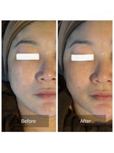 ラビ(RABBI)/40代女性レモンボトルのお客様