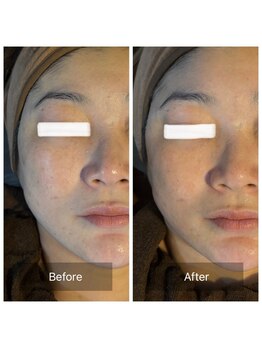 ラビ(RABBI)/40代女性レモンボトルのお客様