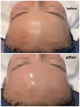 フローラル ビューティー(Floral-Beauty)/韓国美容★スーパージェクション