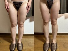 スリール(sourire)/ビフォーアフター