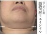 【脂肪分解フェイル】1回で確信!徹底小顔×二重顎・くいしばり60分 12000→