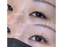 ビューティーカール(BEAUTY CURL)/大阪　メーテルリフトリフト