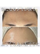 レイ(Rey)/おでこがふっくら丸く