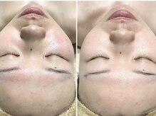 クリアー(CLEAR.)/【Before＆After】