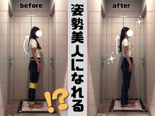 栄光治院 安城院/猫背矯正【ビフォー/アフター】