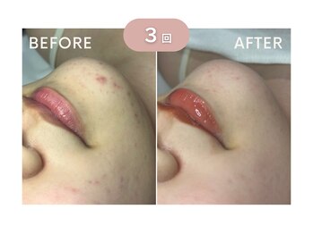 ユーフォリアファステ シルキー(Euphoria Faste Silky)