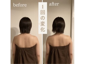 リクゥ(ReQuu)/温ケア×ヘッドスパ×リンパケア