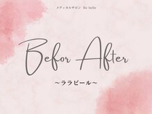 ビベル 八木店(Bebelle)/ビフォーアフター