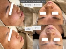 シエル(C i E L.)の雰囲気（最新の肌質改善エステ☆）