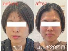 ビーキュート 学芸大学店(BE-CUTE)/Before/After　施術