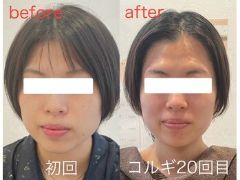 ビーキュート 学芸大学店(BE-CUTE)/Before/After 施術
