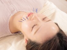 ビハリスト 恵比寿の雰囲気(ほうれい線など気になる部分に直接アプローチ◎)