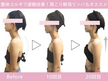 小顔フェイスラボ 栄店(小顔Face Labo.)の雰囲気（整体コルギで肩こり&首コリ解消しながら、猫背・巻き肩も改善◎）