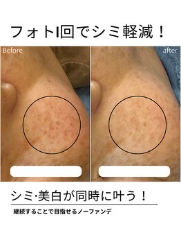 エイチケービューティーサロン(H/K beauty salon)/【1回でも効果実感】